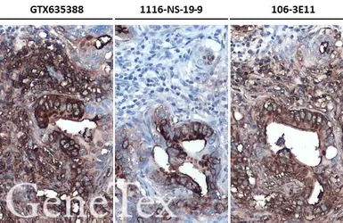 Anti-CA19-9 antibody [GT174] used in IHC (Paraffin sections) (IHC-P). GTX635388