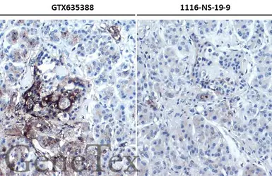 Anti-CA19-9 antibody [GT174] used in IHC (Paraffin sections) (IHC-P). GTX635388