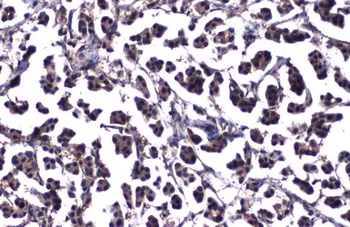 Anti-ATM antibody [2C1-RB] used in IHC (Paraffin sections) (IHC-P). GTX635395