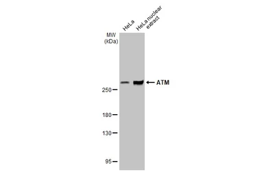 Anti-ATM antibody [2C1-RB] used in Western Blot (WB). GTX635395