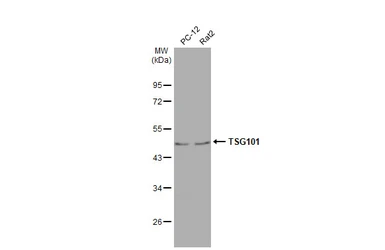 Anti-TSG101 antibody [4A10-RB] used in Western Blot (WB). GTX635396