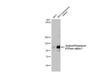 Anti-Sodium/Potassium ATPase alpha 1 antibody [HL114] used in Western Blot (WB). GTX635461