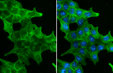 Anti-EpCAM antibody [GT852] used in Immunocytochemistry/ Immunofluorescence (ICC/IF). GTX635474