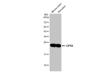 Anti-GPX2 antibody [HL125] used in Western Blot (WB). GTX635477