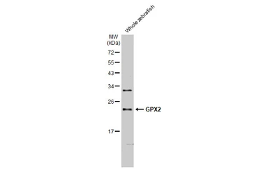 Anti-GPX2 antibody [HL125] used in Western Blot (WB). GTX635477