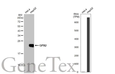 Anti-GPX2 antibody [HL125] used in Western Blot (WB). GTX635477