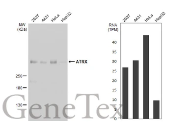 Anti-ATRX antibody [HL1210] used in Western Blot (WB). GTX635478
