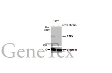Anti-ATRX antibody [HL1210] used in Western Blot (WB). GTX635478