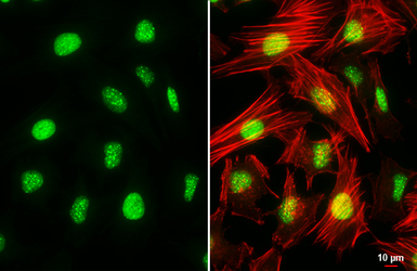 Anti-ATRX antibody [HL1210] used in Immunocytochemistry/ Immunofluorescence (ICC/IF). GTX635478