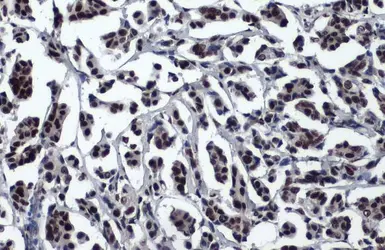 Anti-53BP1 antibody [HL275] used in IHC (Paraffin sections) (IHC-P). GTX635479