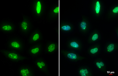 Anti-53BP1 antibody [HL275] used in Immunocytochemistry/ Immunofluorescence (ICC/IF). GTX635479