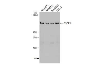 Anti-53BP1 antibody [HL275] used in Western Blot (WB). GTX635479