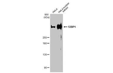 Anti-53BP1 antibody [HL275] used in Western Blot (WB). GTX635479