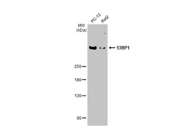 Anti-53BP1 antibody [HL275] used in Western Blot (WB). GTX635479