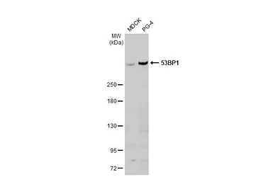 Anti-53BP1 antibody [HL275] used in Western Blot (WB). GTX635479