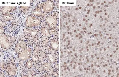 Anti-53BP1 antibody [HL275] used in IHC (Paraffin sections) (IHC-P). GTX635479