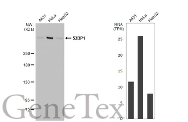 Anti-53BP1 antibody [HL275] used in Western Blot (WB). GTX635479