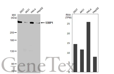 Anti-53BP1 antibody [HL275] used in Western Blot (WB). GTX635479