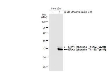 Anti-ERK1 (phospho Thr202/Tyr204) + ERK2 (phospho Thr185/Tyr187) antibody [HL173] used in Western Blot (WB). GTX635617