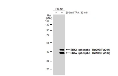 Anti-ERK1 (phospho Thr202/Tyr204) + ERK2 (phospho Thr185/Tyr187) antibody [HL173] used in Western Blot (WB). GTX635617