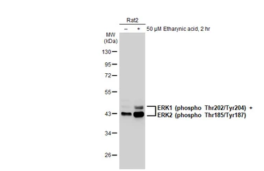 Anti-ERK1 (phospho Thr202/Tyr204) + ERK2 (phospho Thr185/Tyr187) antibody [HL173] used in Western Blot (WB). GTX635617