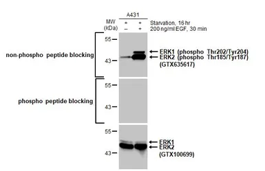 Anti-ERK1 (phospho Thr202/Tyr204) + ERK2 (phospho Thr185/Tyr187) antibody [HL173] used in Western Blot (WB). GTX635617
