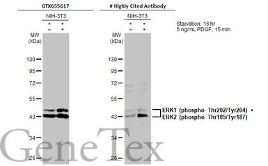 Anti-ERK1 (phospho Thr202/Tyr204) + ERK2 (phospho Thr185/Tyr187) antibody [HL173] used in Western Blot (WB). GTX635617
