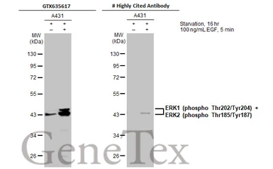 Anti-ERK1 (phospho Thr202/Tyr204) + ERK2 (phospho Thr185/Tyr187) antibody [HL173] used in Western Blot (WB). GTX635617