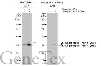 Anti-ERK1 (phospho Thr202/Tyr204) + ERK2 (phospho Thr185/Tyr187) antibody [HL173] used in Western Blot (WB). GTX635617