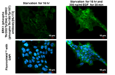 Anti-ERK1 (phospho Thr202/Tyr204) + ERK2 (phospho Thr185/Tyr187) antibody [HL173] used in Immunocytochemistry/ Immunofluorescence (ICC/IF). GTX635617