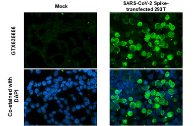 Anti-SARS-CoV-2 (COVID-19) Spike S1 antibody [HL1] used in Immunocytochemistry/ Immunofluorescence (ICC/IF). GTX635656