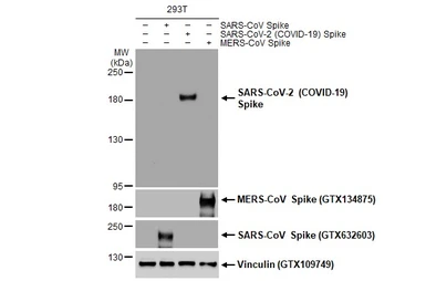 Anti-SARS-CoV-2 (COVID-19) Spike S1 antibody [HL1] used in Western Blot (WB). GTX635656