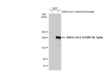 Anti-SARS-CoV-2 (COVID-19) Spike S1 antibody [HL1] used in Western Blot (WB). GTX635656