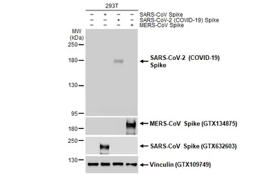 Anti-SARS-CoV-2 (COVID-19) Spike S1 antibody [HL134] used in Western Blot (WB). GTX635671