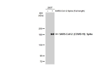 Anti-SARS-CoV-2 (COVID-19) Spike S1 antibody [HL134] used in Western Blot (WB). GTX635671