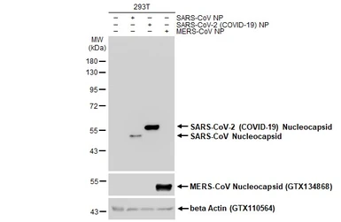 Anti-SARS-CoV-2 (COVID-19) Nucleocapsid antibody [HL146] used in Western Blot (WB). GTX635680