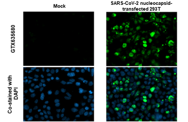 Anti-SARS-CoV-2 (COVID-19) Nucleocapsid antibody [HL146] used in Immunocytochemistry/ Immunofluorescence (ICC/IF). GTX635680