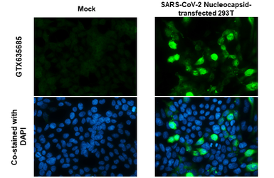 Anti-SARS-CoV-2 (COVID-19) Nucleocapsid antibody [HL5410] used in Immunocytochemistry/ Immunofluorescence (ICC/IF). GTX635685