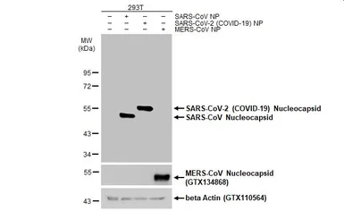 Anti-SARS-CoV-2 (COVID-19) Nucleocapsid antibody [HL5410] used in Western Blot (WB). GTX635685