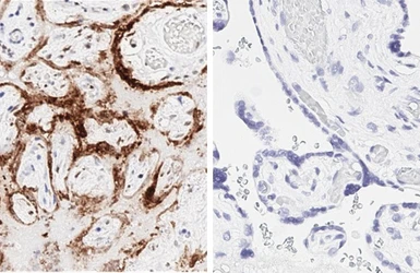 Anti-SARS-CoV-2 (COVID-19) Nucleocapsid antibody [HL448] used in IHC (Paraffin sections) (IHC-P). GTX635686