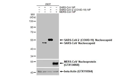 Anti-SARS-CoV-2 (COVID-19) Nucleocapsid antibody [HL448] used in Western Blot (WB). GTX635686