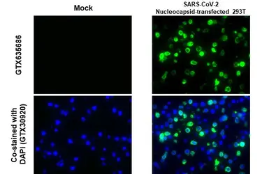 Anti-SARS-CoV-2 (COVID-19) Nucleocapsid antibody [HL448] used in IHC-P (cell pellet) (IHC-P (cell pellet)). GTX635686