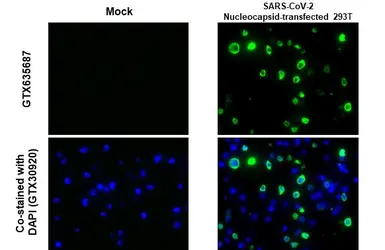 Anti-SARS-CoV-2 (COVID-19) Nucleocapsid antibody [HL453] used in IHC-P (cell pellet) (IHC-P (cell pellet)). GTX635687