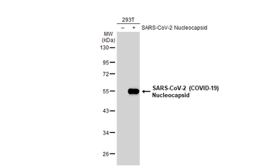 Anti-SARS-CoV-2 (COVID-19) Nucleocapsid antibody [HL453] used in Western Blot (WB). GTX635687