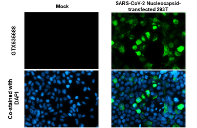 Anti-SARS-CoV-2 (COVID-19) Nucleocapsid antibody [HL455] used in Immunocytochemistry/ Immunofluorescence (ICC/IF). GTX635688