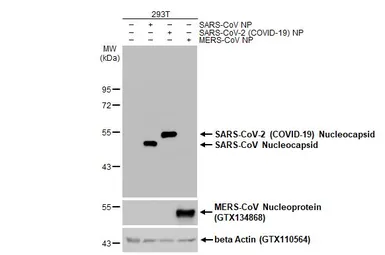 Anti-SARS-CoV-2 (COVID-19) Nucleocapsid antibody [HL455] used in Western Blot (WB). GTX635688