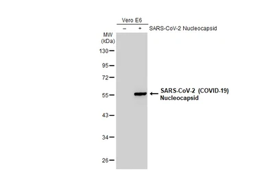 Anti-SARS-CoV-2 (COVID-19) Nucleocapsid antibody [HL455] used in Western Blot (WB). GTX635688