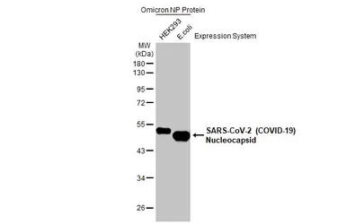 Anti-SARS-CoV-2 (COVID-19) Nucleocapsid antibody [HL5511] used in Western Blot (WB). GTX635689