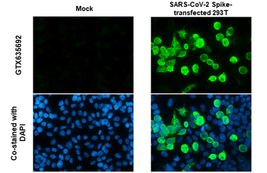 Anti-SARS-CoV-2 (COVID-19) Spike RBD antibody [HL257] used in Immunocytochemistry/ Immunofluorescence (ICC/IF). GTX635692