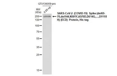 Anti-SARS-CoV-2 (COVID-19) Spike RBD antibody [HL257] used in Western Blot (WB). GTX635692